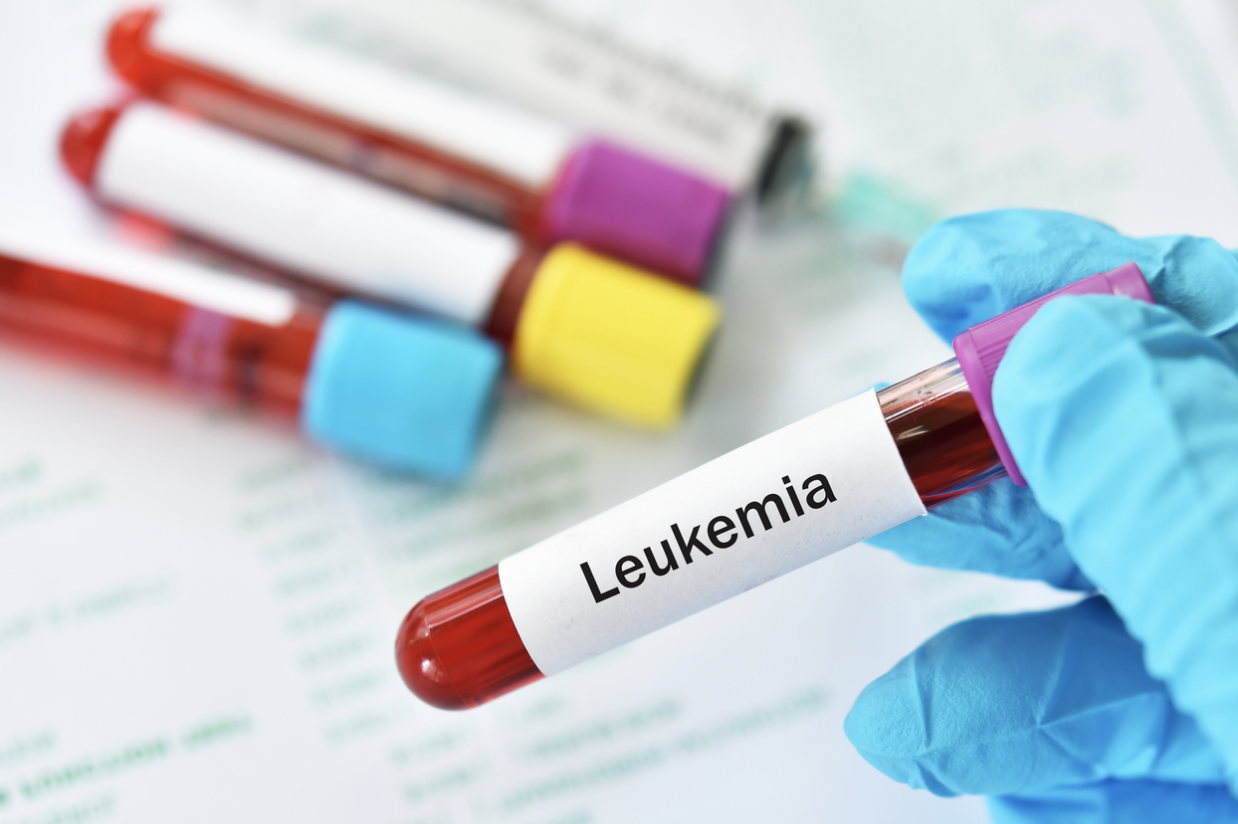 Multiple vials of blood on table with blue gloved hand holding one vial with label reading "leukemia".